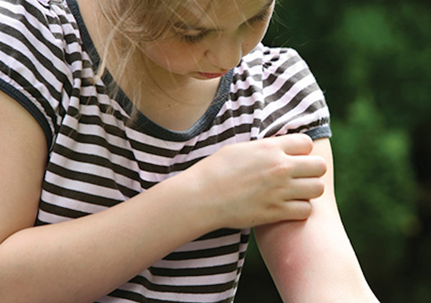 Proven_Insect_Repellent_Itch_girl_bug_bites_