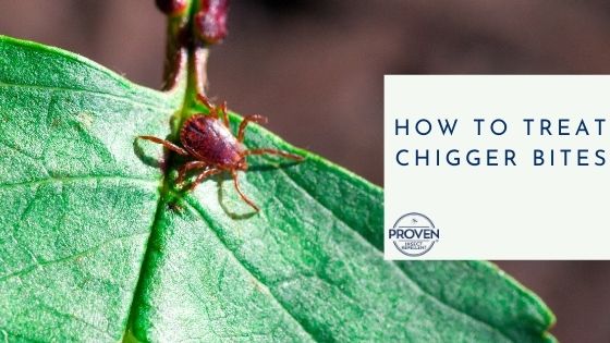 How to Treat Chigger Bites
